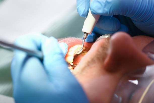 Best Emergency Dental Services for Seniors in Montgomery, IN
