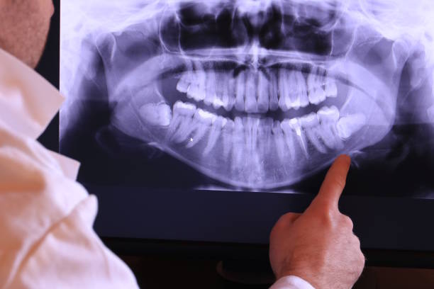 Best Emergency Root Canal Treatment in Montgomery, IN