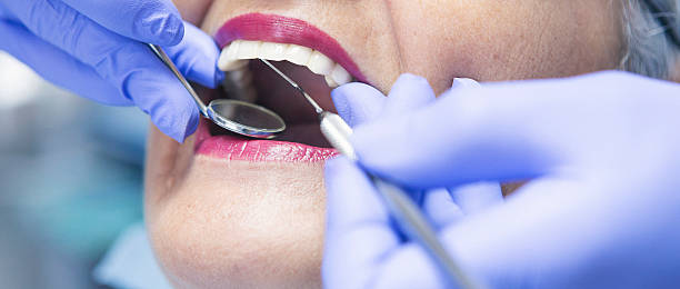 Best Emergency Dentist for Knocked-Out Tooth in Montgomery, IN